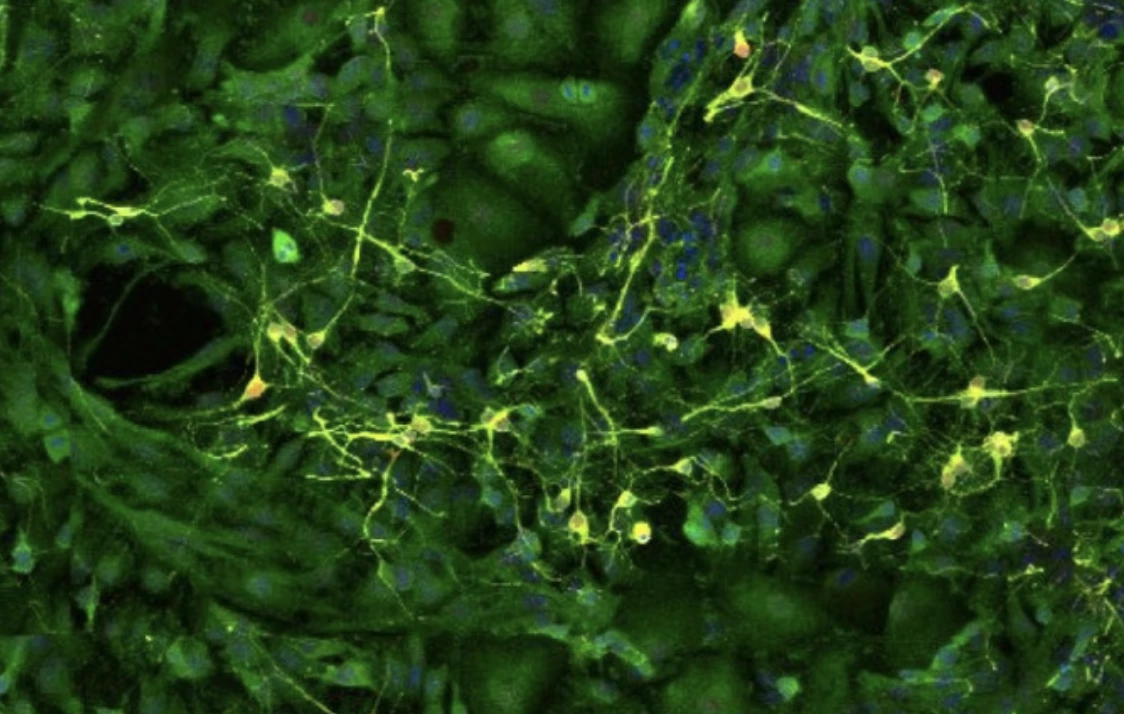 Hippocampal neurons (yellow) surrounded by astrocytes (green) in a cell culture from the study