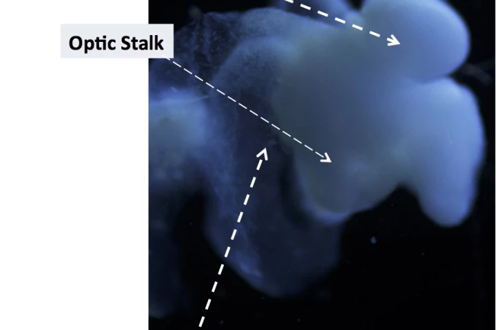 This image of the lab-grown brain is labeled to show identifiable structures