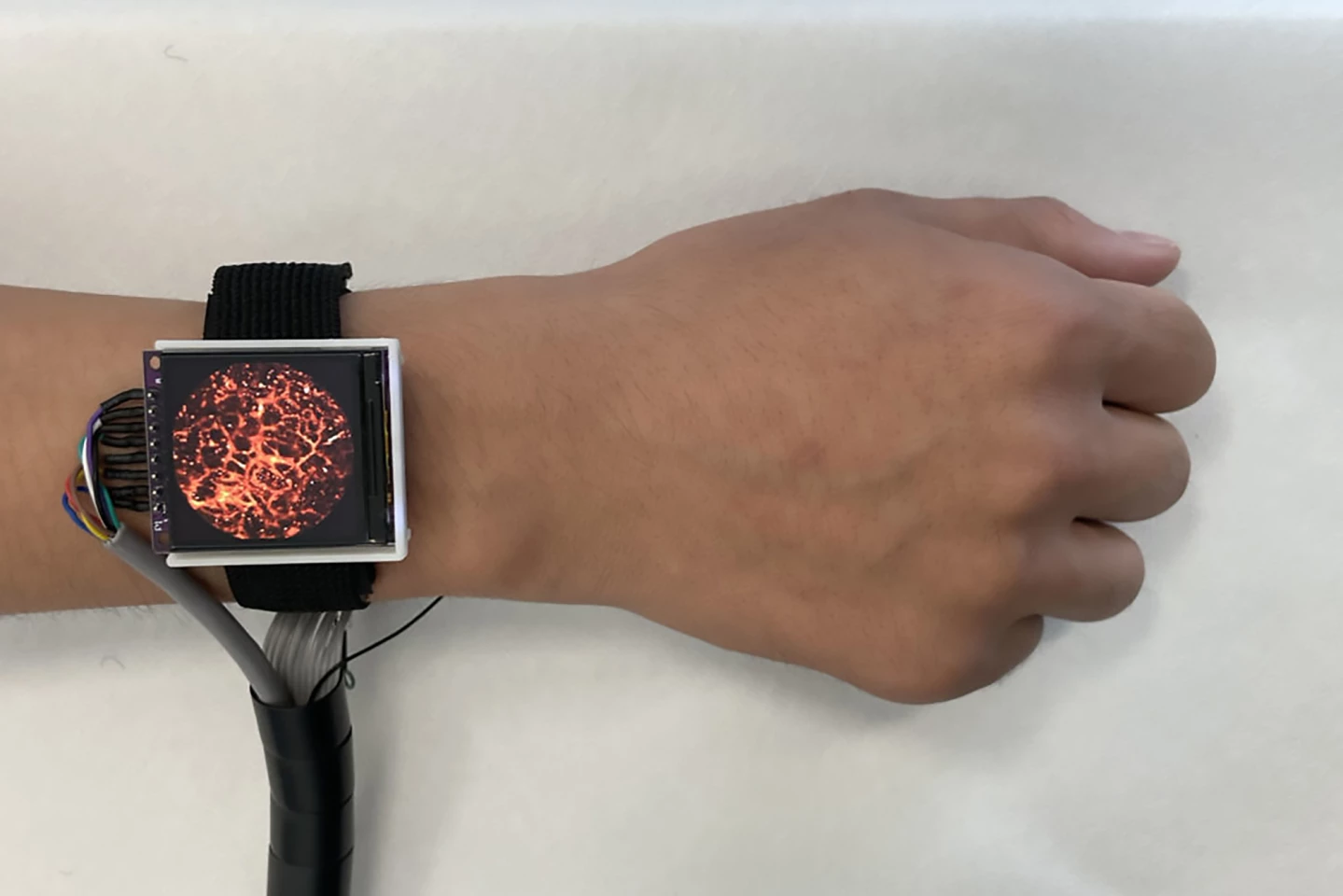 The photoacoustic watch can capture high-resolution images of blood vessels in the skin