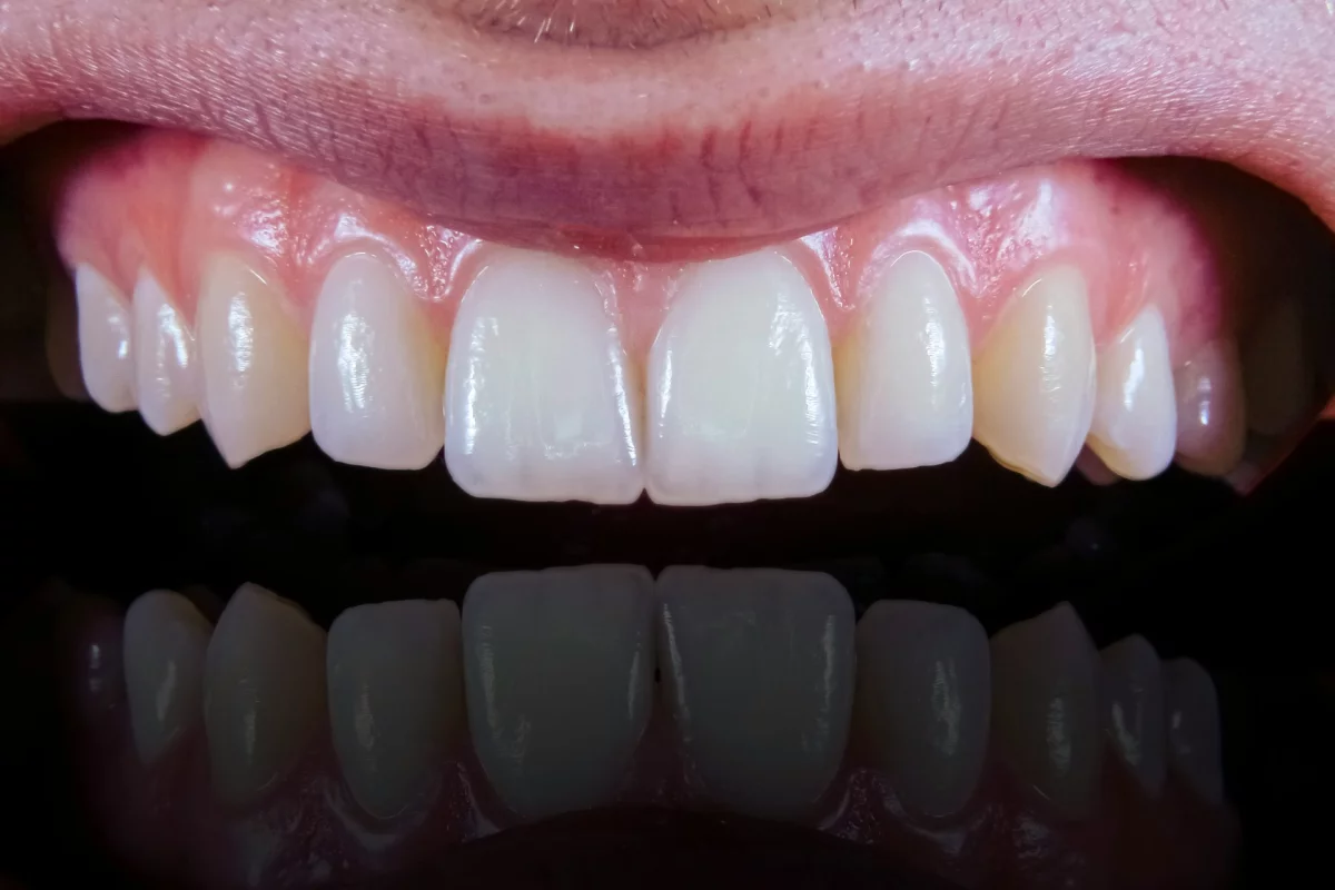 Healthy gums like these might be within reach if you eat according to the Mediterranean diet, says a new study