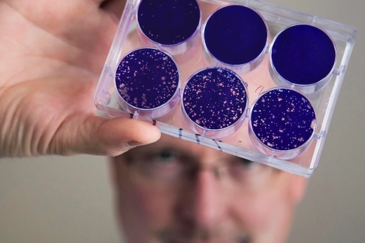 Dr. Matthias Grimier holding up a sample of the modified poliovirus that can attack and kill tumor cells