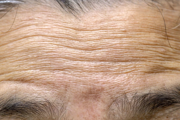 Research has revealed why wrinkles form as we age