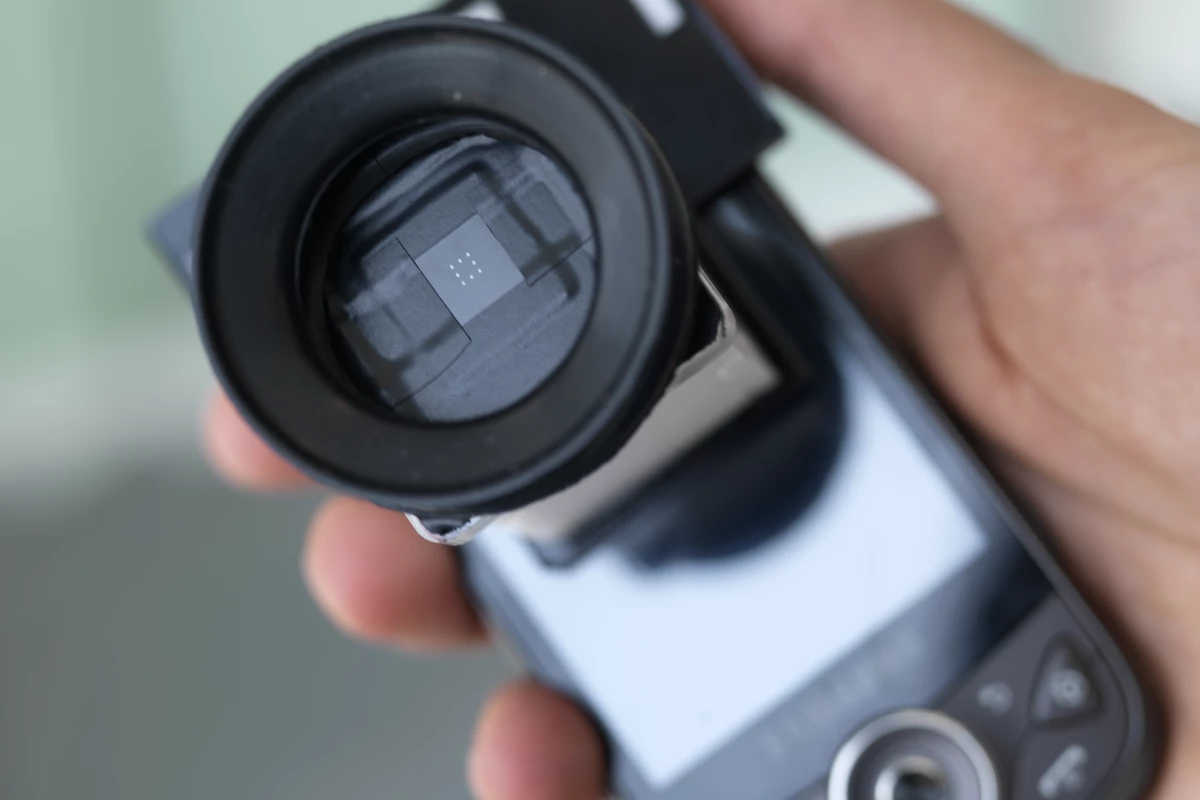 Netra Uses Of Mobile Phones To Deliver Simple Cheap Eye Tests