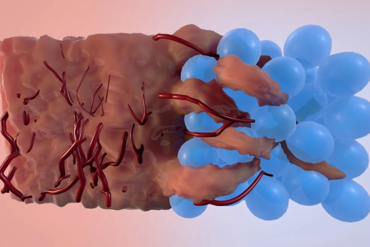 The new hydrogel contains tiny synthetic spheres that grip onto one another to form a permeable structure