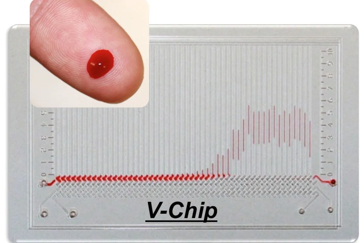 The V-chip is an inexpensive credit card-sized device, that can instantly test a single drop of blood for up to 50 different substances