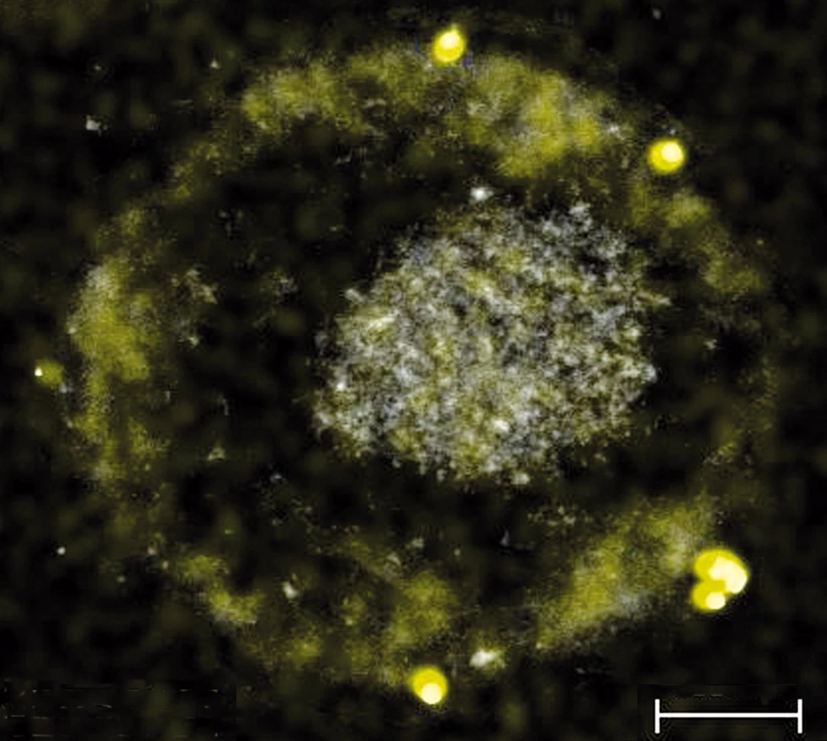 The C. metallidurans bacteria, along with some of the tiny gold nuggets it excretes