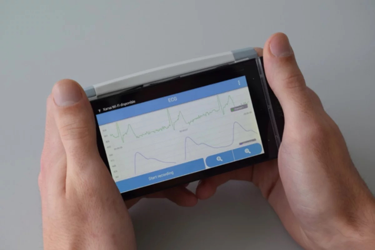 CardioSense uses two metal contact plates, which could be incorporated into various types of devices