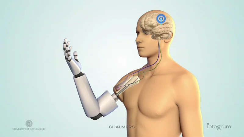 Nerve impulses from the brain control the Chalmers University prosthesis