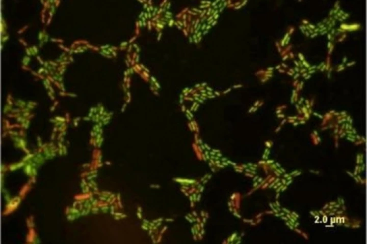A magnification of E. coli exposed to a low concentration (10 mg/L) of titanium dioxide nanoparticles. Cells with compromised membranes are stained red.Pic credit: University of Toledo