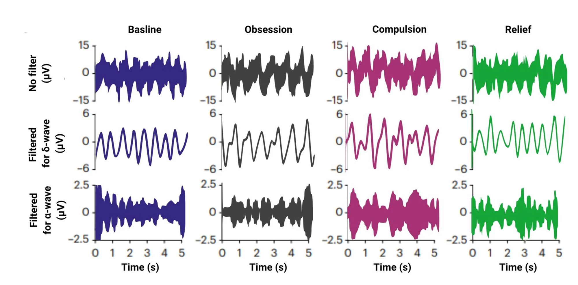 Alpha (⍺) and delta (δ) brainwaves appeared relatively frequently across the entire brain network during the study