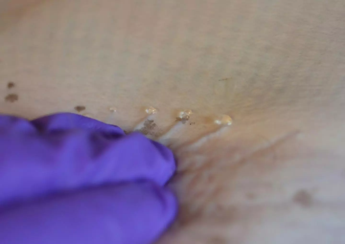 The "jelly" seen on the skin of a skate