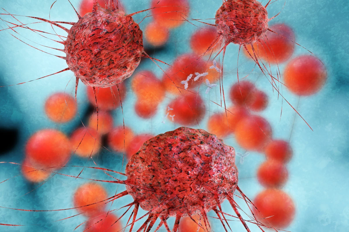 A new cancer diagnosis technique works by isolating circulating tumor cells (CTCs) from a blood sample