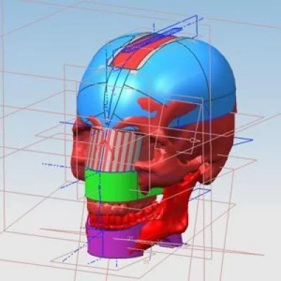 The Chewing Robot concept (Image: Dr. Daniel Raabe)