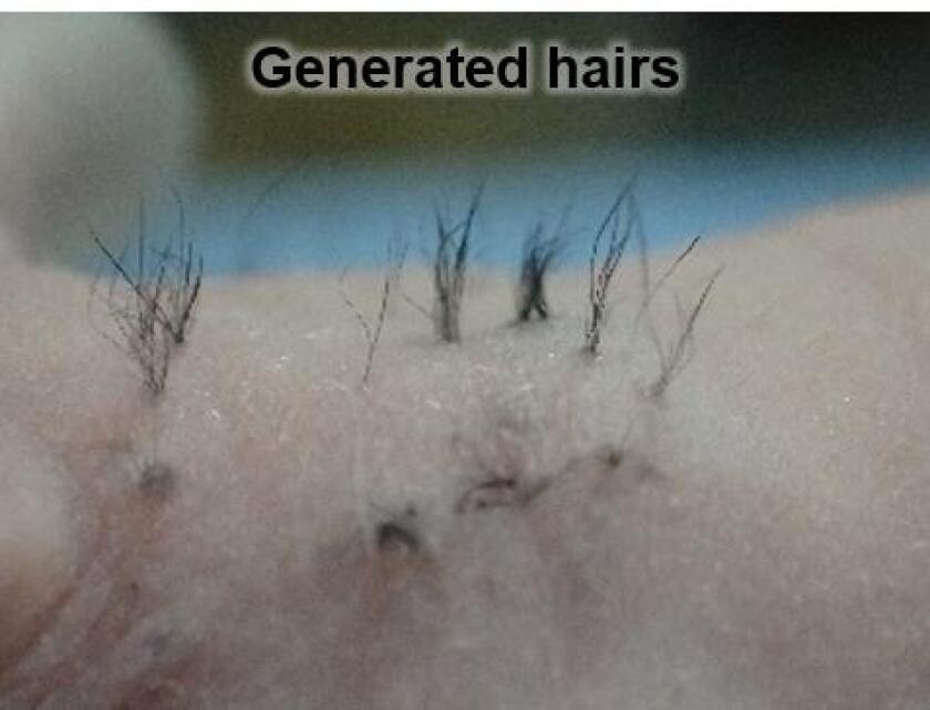 Scientists implanted their new hair follicle germs onto the backs of mice, with promising results