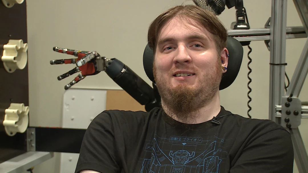 Nathan Copeland, paralyzed for over 10 years, has been able to experience the sensation of touch again through a robotic arm developed by the University of Pittsburgh and UPMC