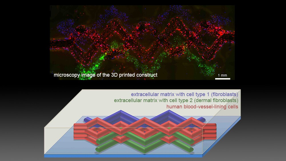 The third ink was designed to melt, not as it warms but as it cools. This meant that once the team had used it to create a network of filaments, it could be chilled, melted and ultimately sucked out of the tissue, leaving a network of hollow tubes in its place