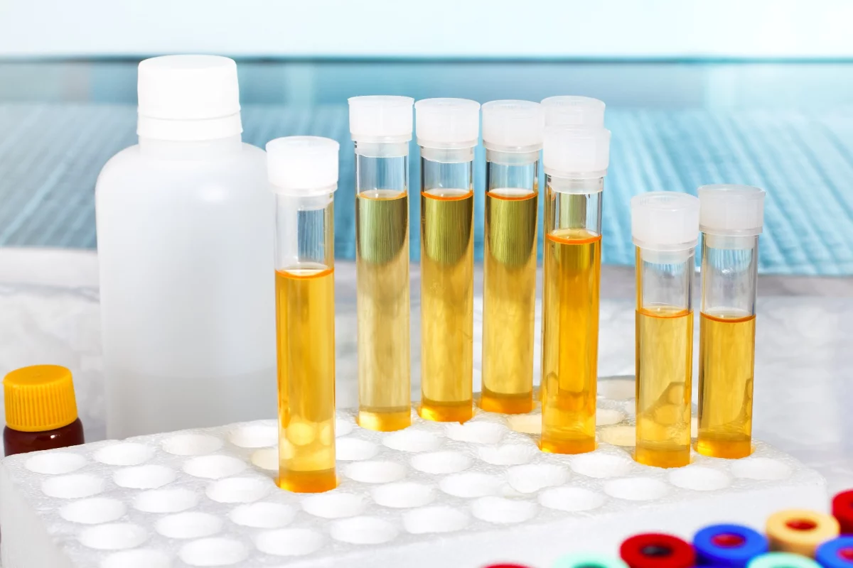 A GHB metabolite shows up in the urine even 20 hours after the drug has been ingested