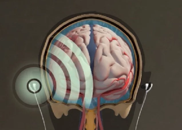HeadSense says it has an alternative to invasive procedures to monitor pressure in the skull