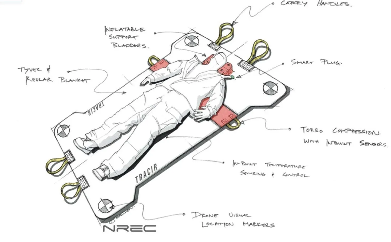 Concept sketch of the TRAuma Care In a Rucksack (TRACIR) system
