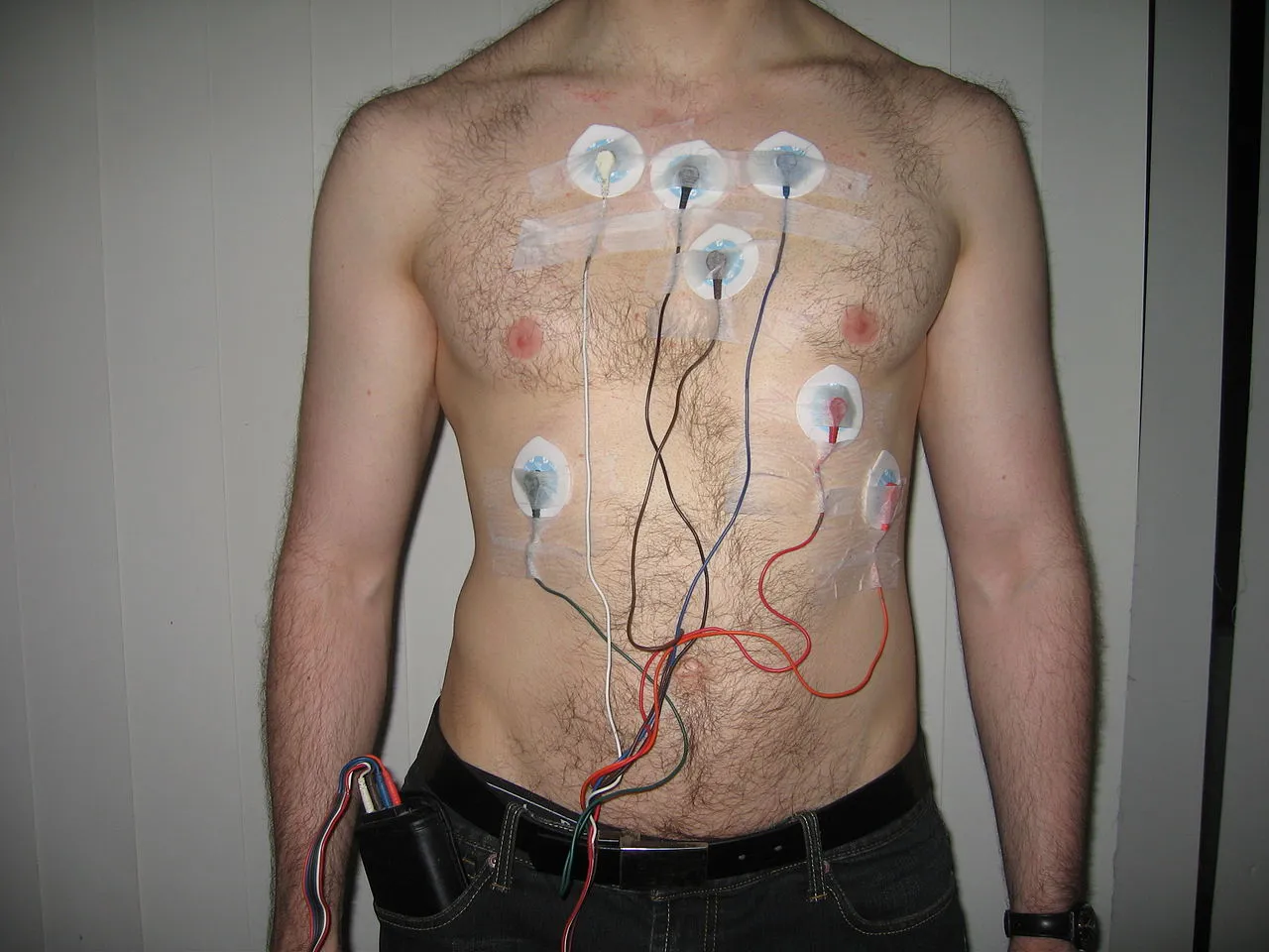 A Holter monitor setup (Photo: Jason7825)