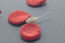 Researchers gene edited
                              the Leishmania major parasite so it could
                              be used in a vaccine without causing
                              disease