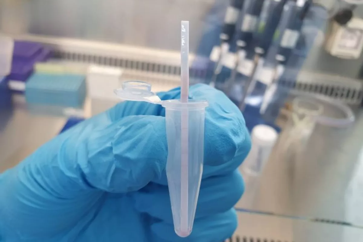 Once commercialized, the kit should cost around $10 to $16