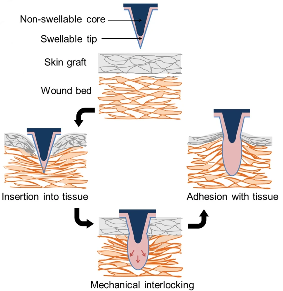 The microneedle patches reportedly produce over three times the adhesion strength of sutures or surgical staples (Image: Karp lab)