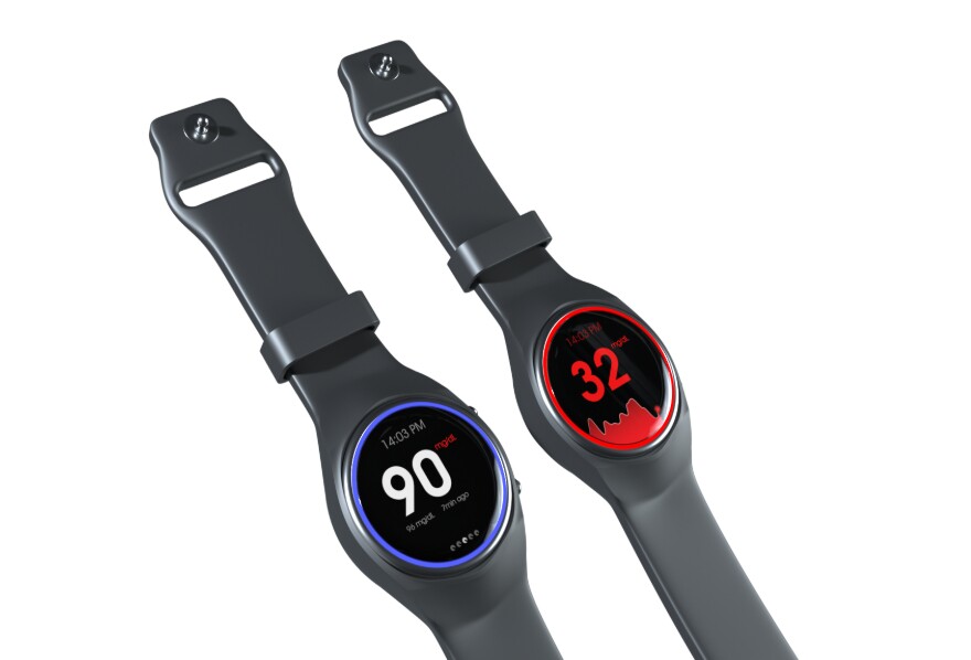 A non-invasive, real-time glucose monitoring smartwatch