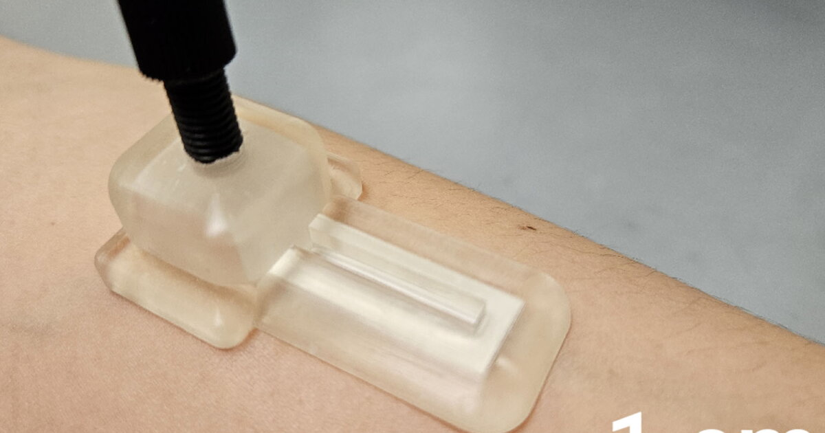 Patch Skin String Smart skin patch offers painless blood test alternative