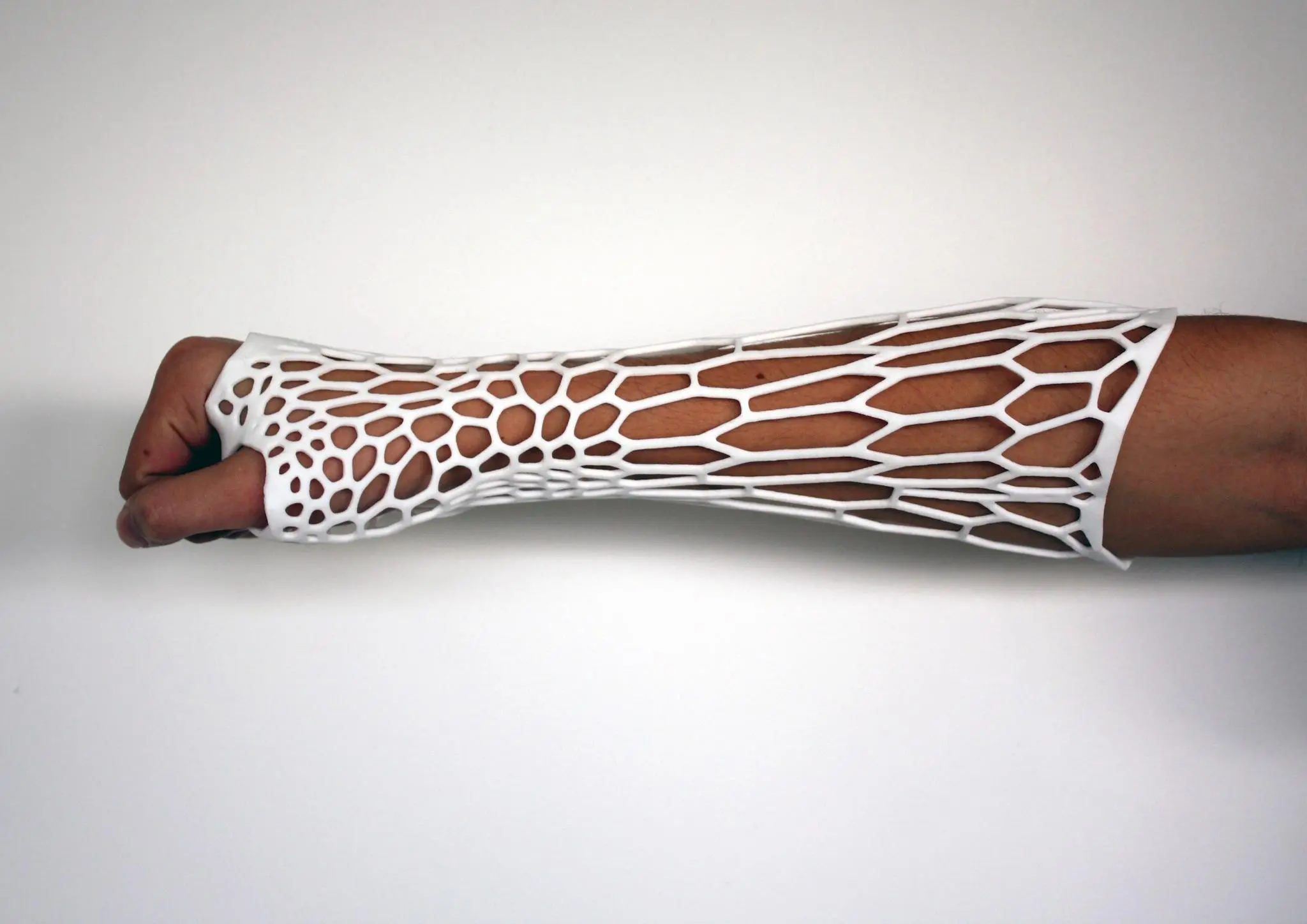 The Cortex Fracture Support system