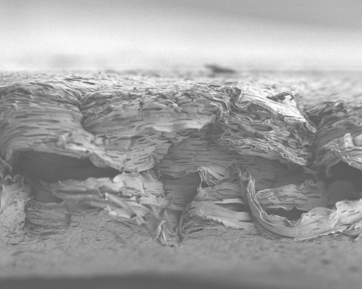The scaffold has the potential to do away with the painful, invasive procedures currently used to repair/replace bone (Image: MIT)