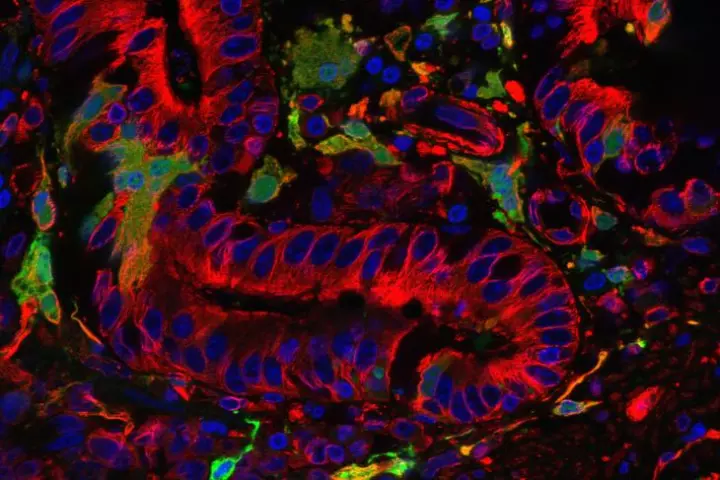 Rinderpest virus is the most lethal cattle disease ever known