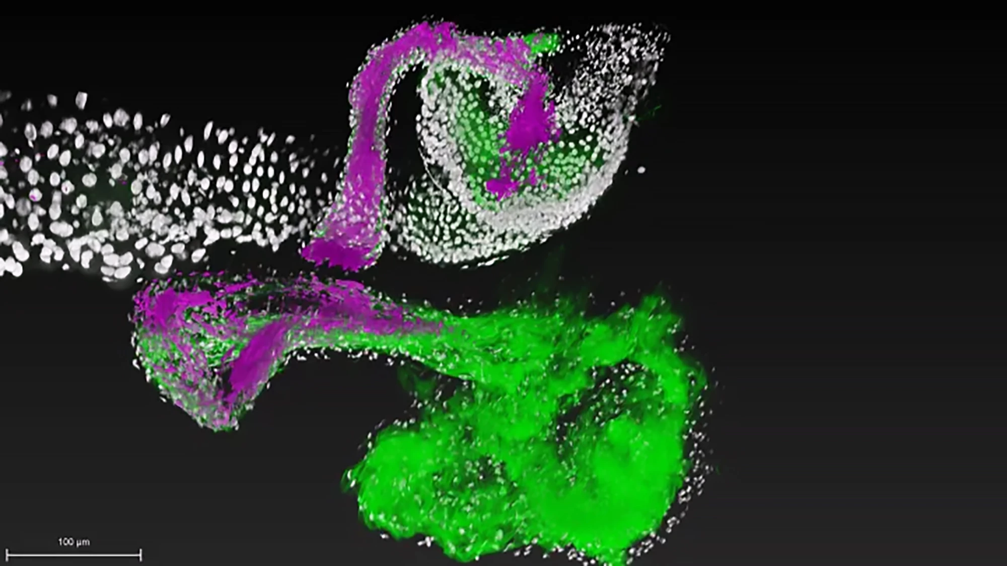 A beneficial bacteria (magenta) attaches to specific regions of the gut (green)