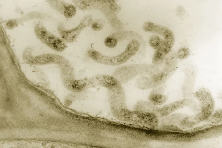 A microscope image of the helix-shaped bacteria Spiroplasma, proteins from which have been used to create the smallest synthetic bacteria that can move on its own