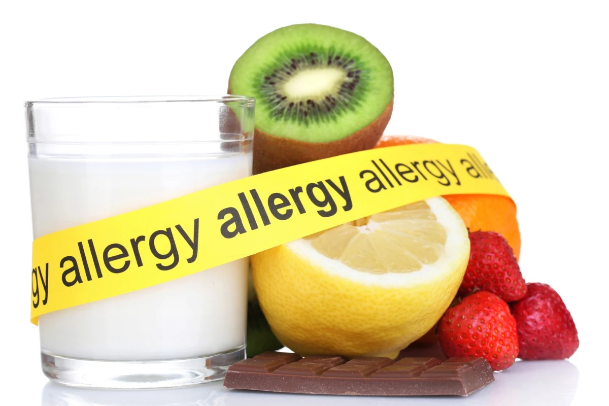 Research has revealed only food allergies seemed to correlate with increased MS disease activity, and not environmental or drug allergies