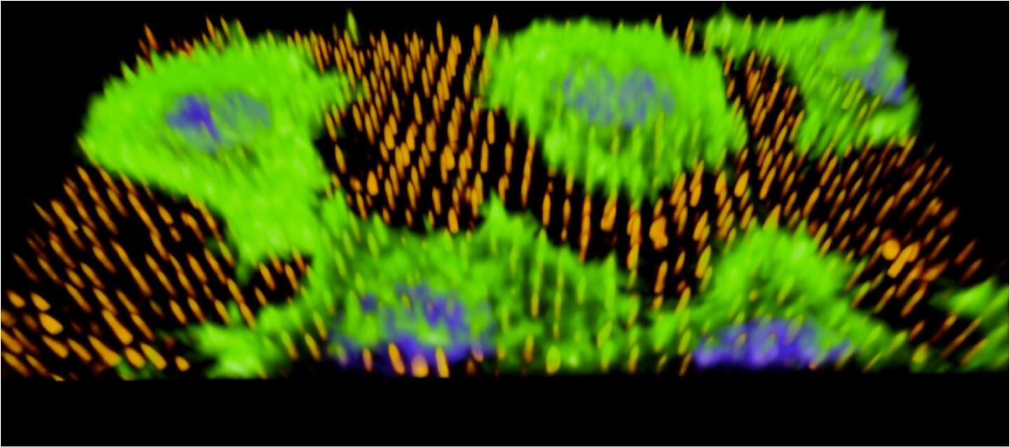 Human cells (green) on the nanoneedles (orange), getting DNA injected into their nuclei (blue) (Image: Imperial College London)