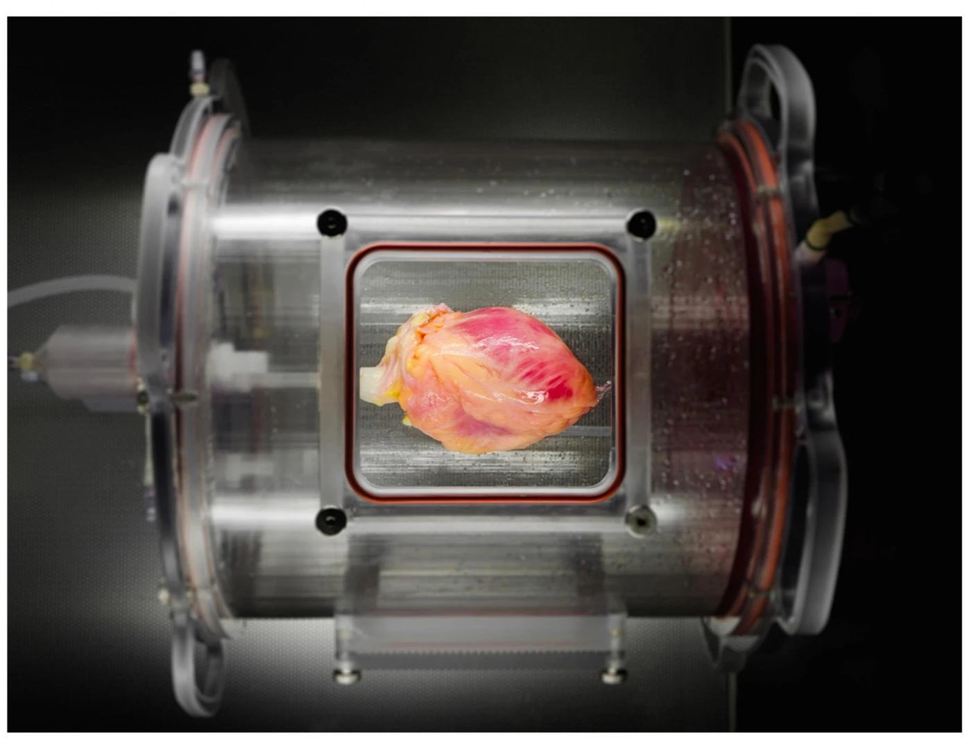 A partially recellularized human whole-heart cardiac scaffold, reseeded with human cardiomyocytes derived from induced pluripotent stem cells, being cultured in a bioreactor