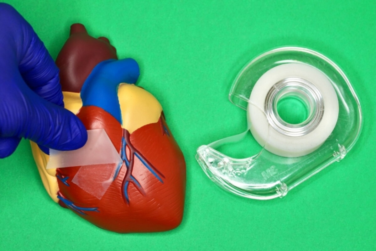 An MIT team has created surgical tape that can hold strong but also be removed when needed