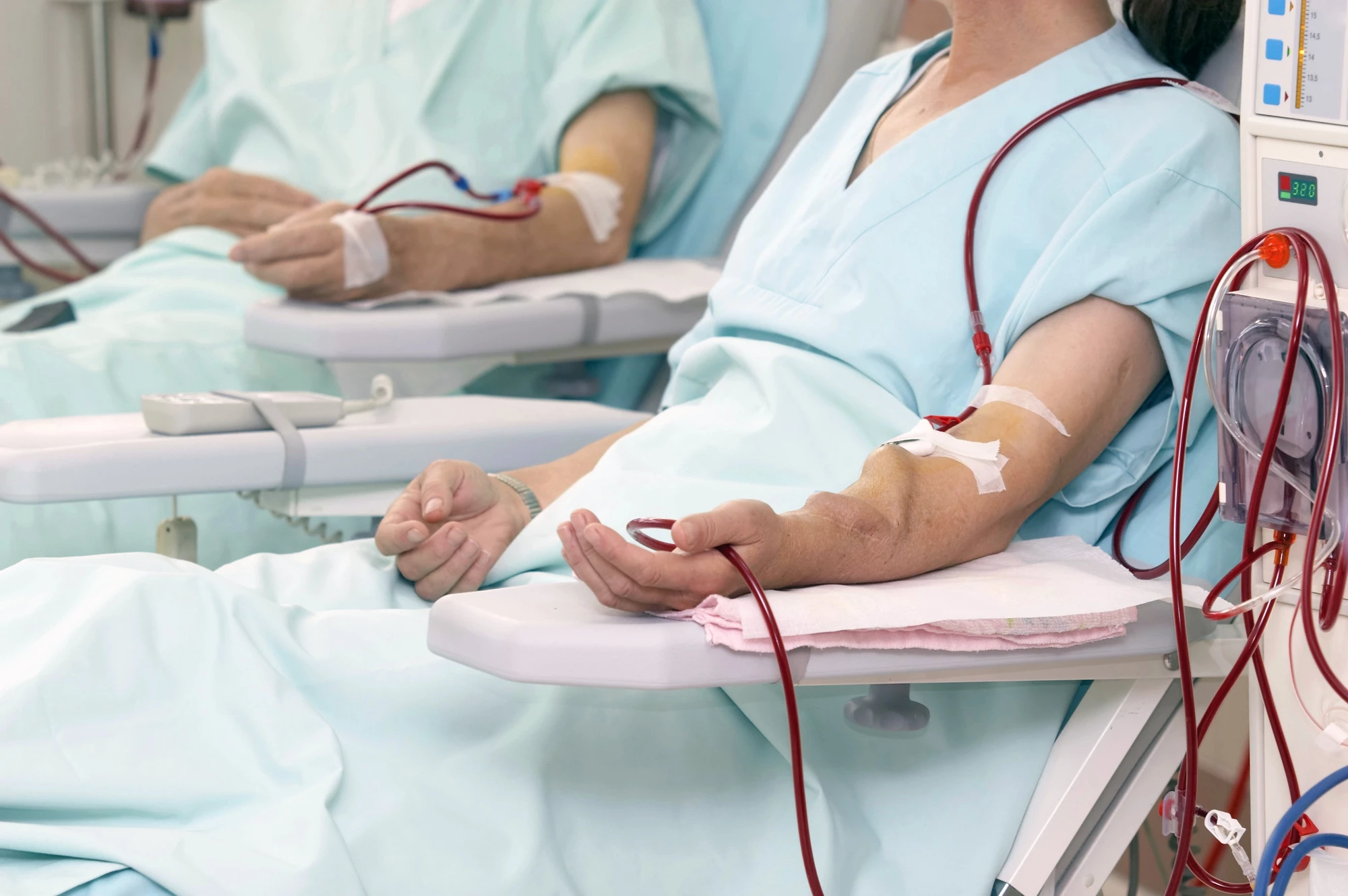 Dialysis does the kidneys' filtering when they can't