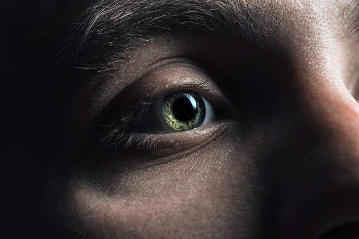 Semaglutide (Ozempic, Wegovy) has been associated with an uncommon form of blindness