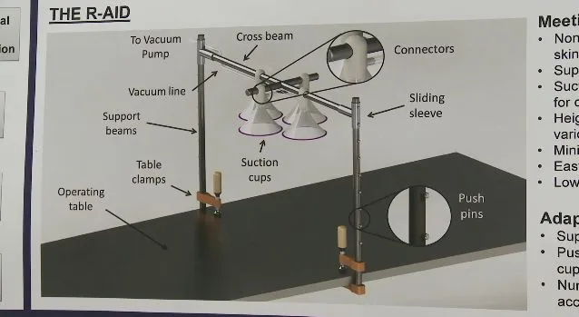 A diagram of the R-Aide