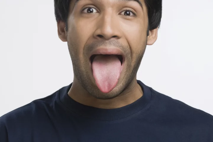Medicated dissolvable oral strips have been developed to treat minor burns inside the mouth (Photo: Shutterstock)
