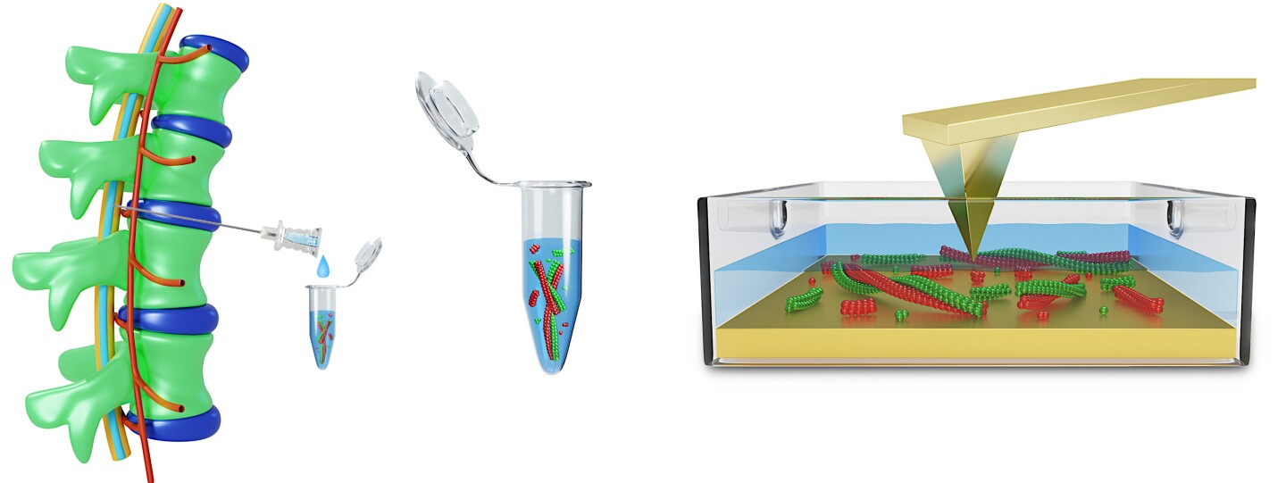 Schematic of the CSF extraction and analyzing process. Spinal fluid is collected and then deposited onto a gold substrate within a liquid cell, where the proteins (red and green) are imaged using AFM