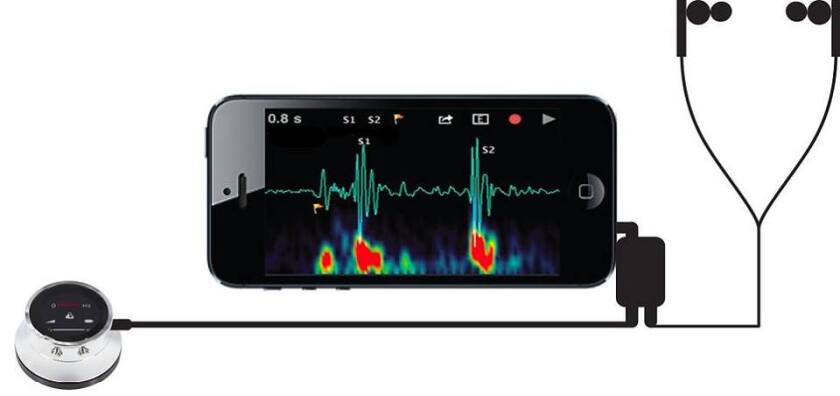 Using the Thinklabs Stethoscope app, doctors are able to make and then selectively filter audio recordings in order to better listen for specific conditions