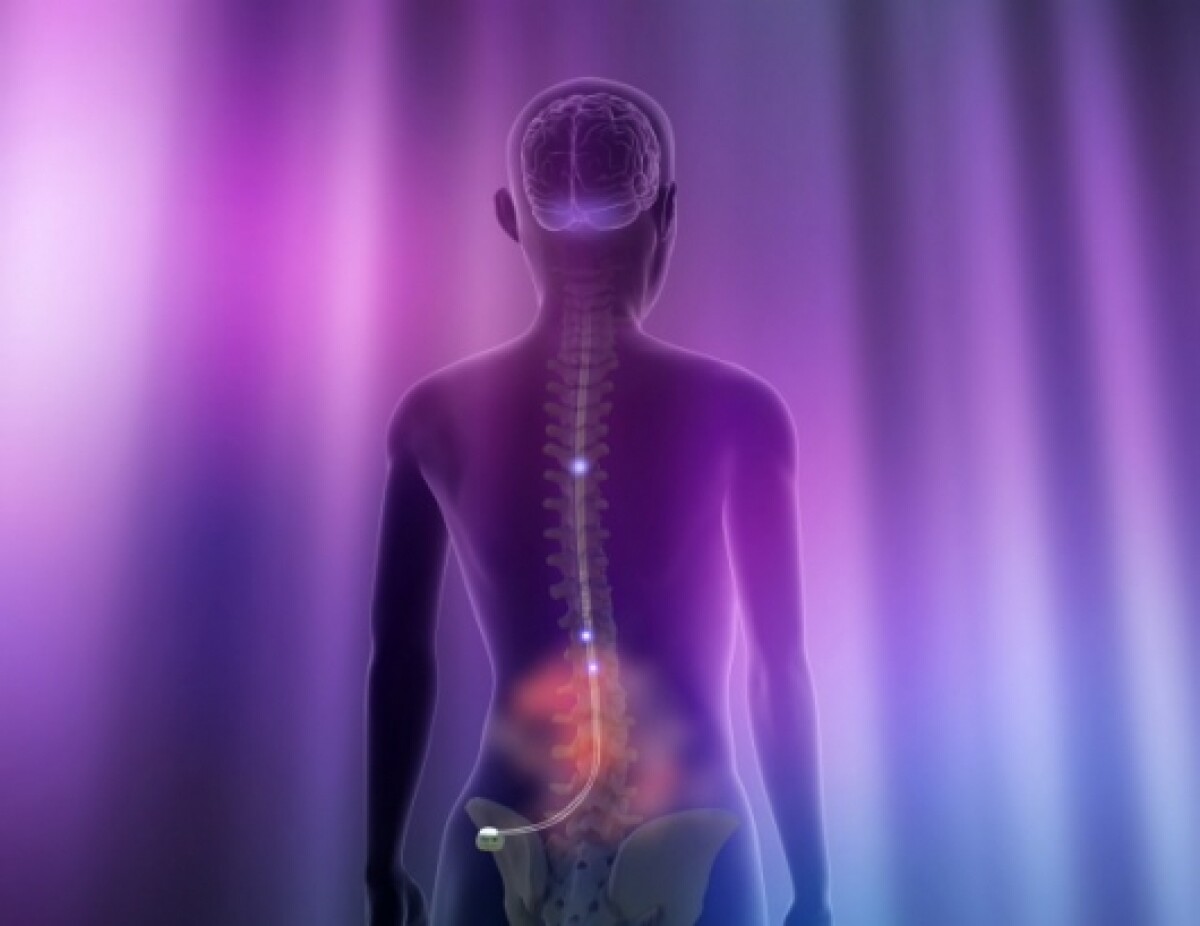 spine stimulator