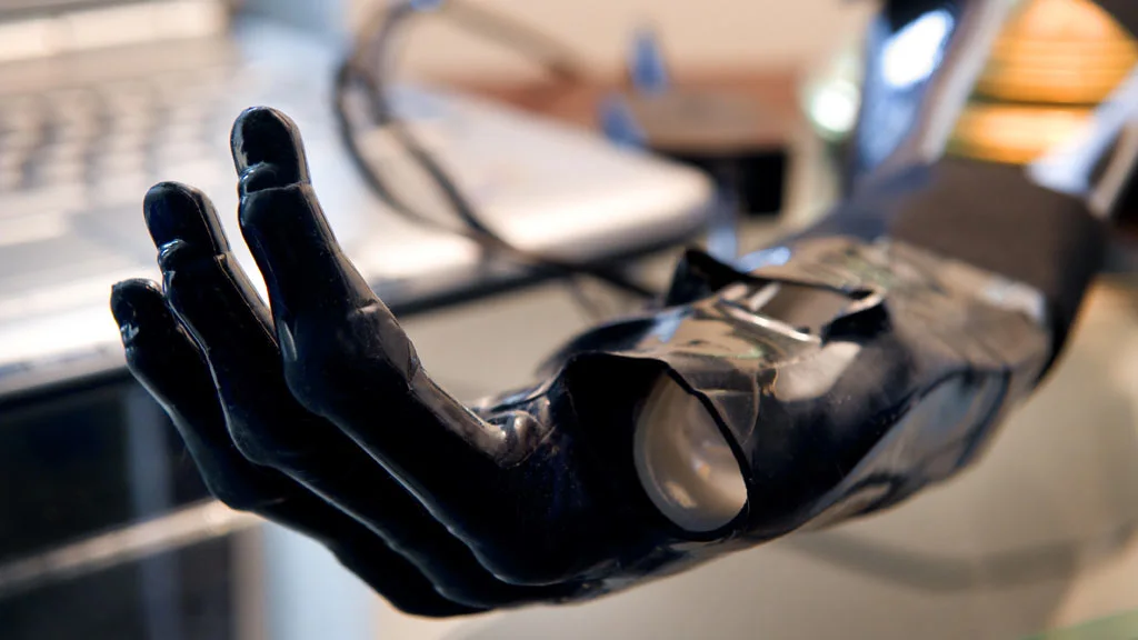 The Touch Bionics ProDigits bionic finger