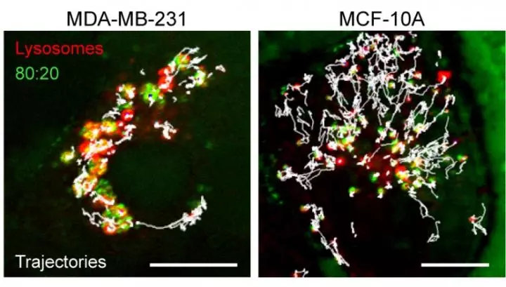 Clusters of charged nanoparticles aggregate in cancer cells (left), compared to normal cells (right)