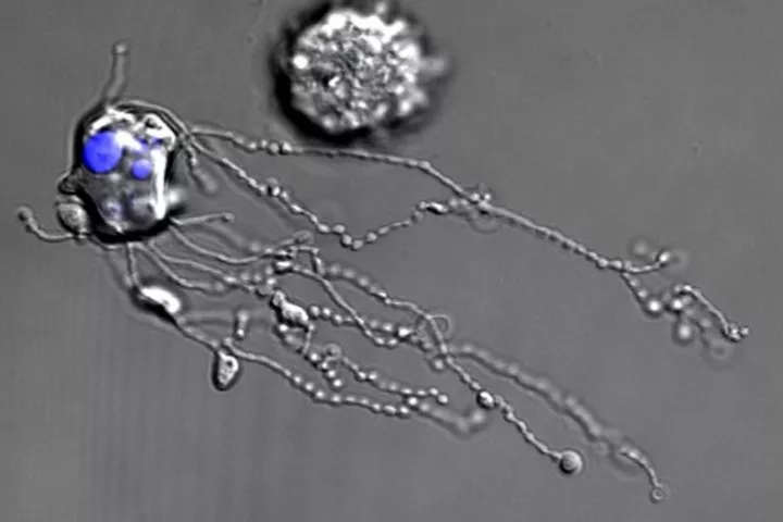 The first-of-its-kind video shows the white blood cells to eject a string of proteins as they die