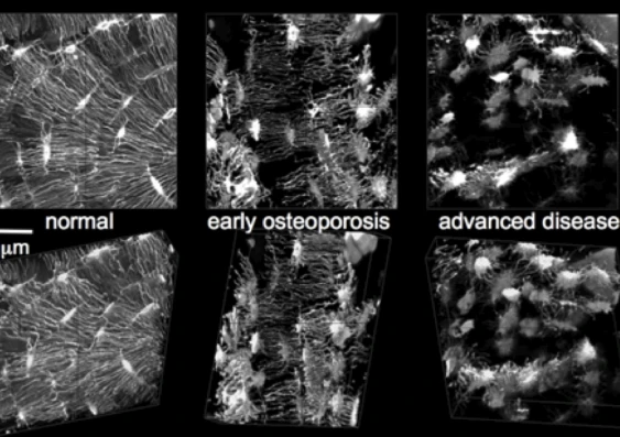 The UNSW researchers were able to use the new imaging technique to identify new links between disease status and molecular transport in osteoarthritic guinea pigs (Image: UNSW)