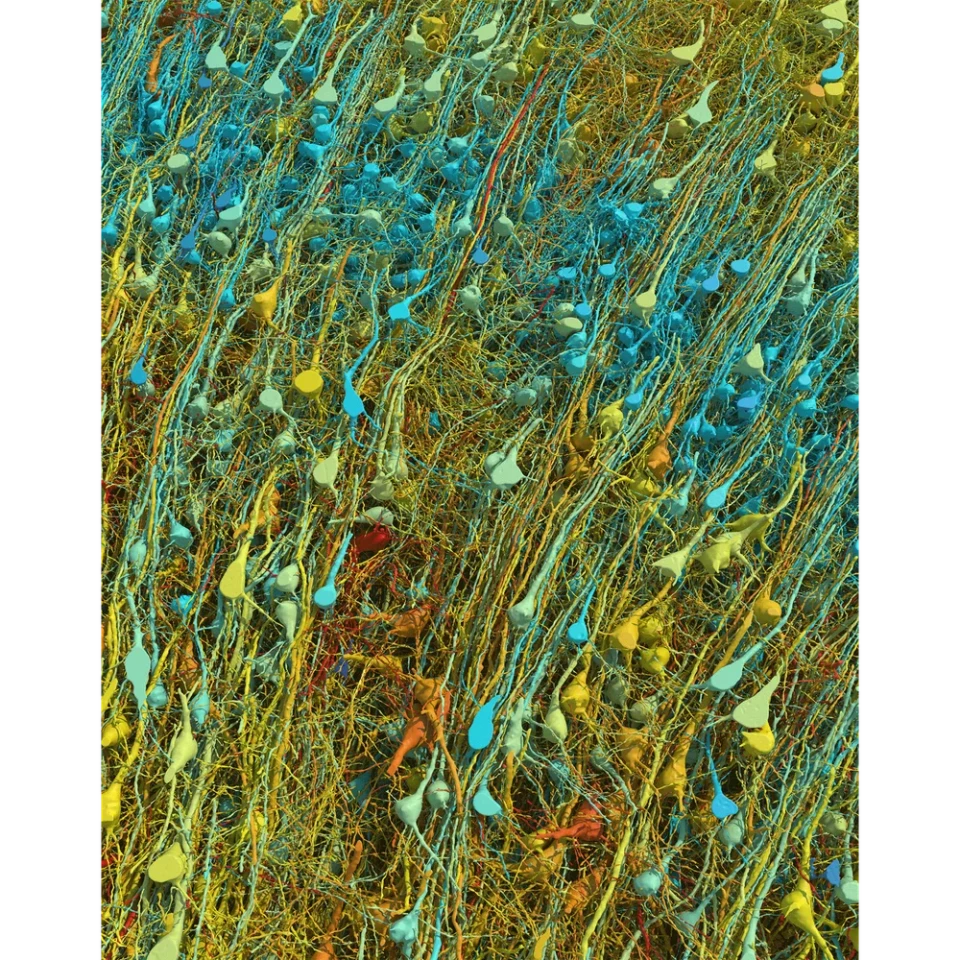 A close up image of neurons